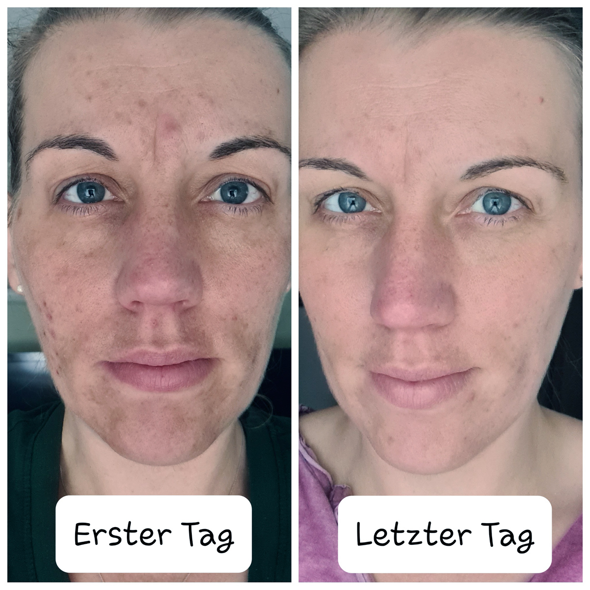 Skinlovers 4 Wochen Test