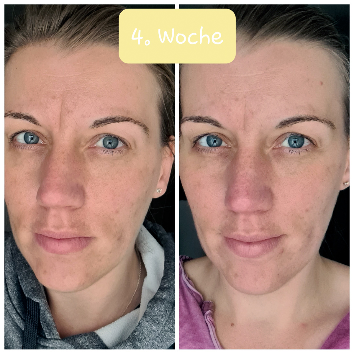 Skinlovers 4 Wochen Test