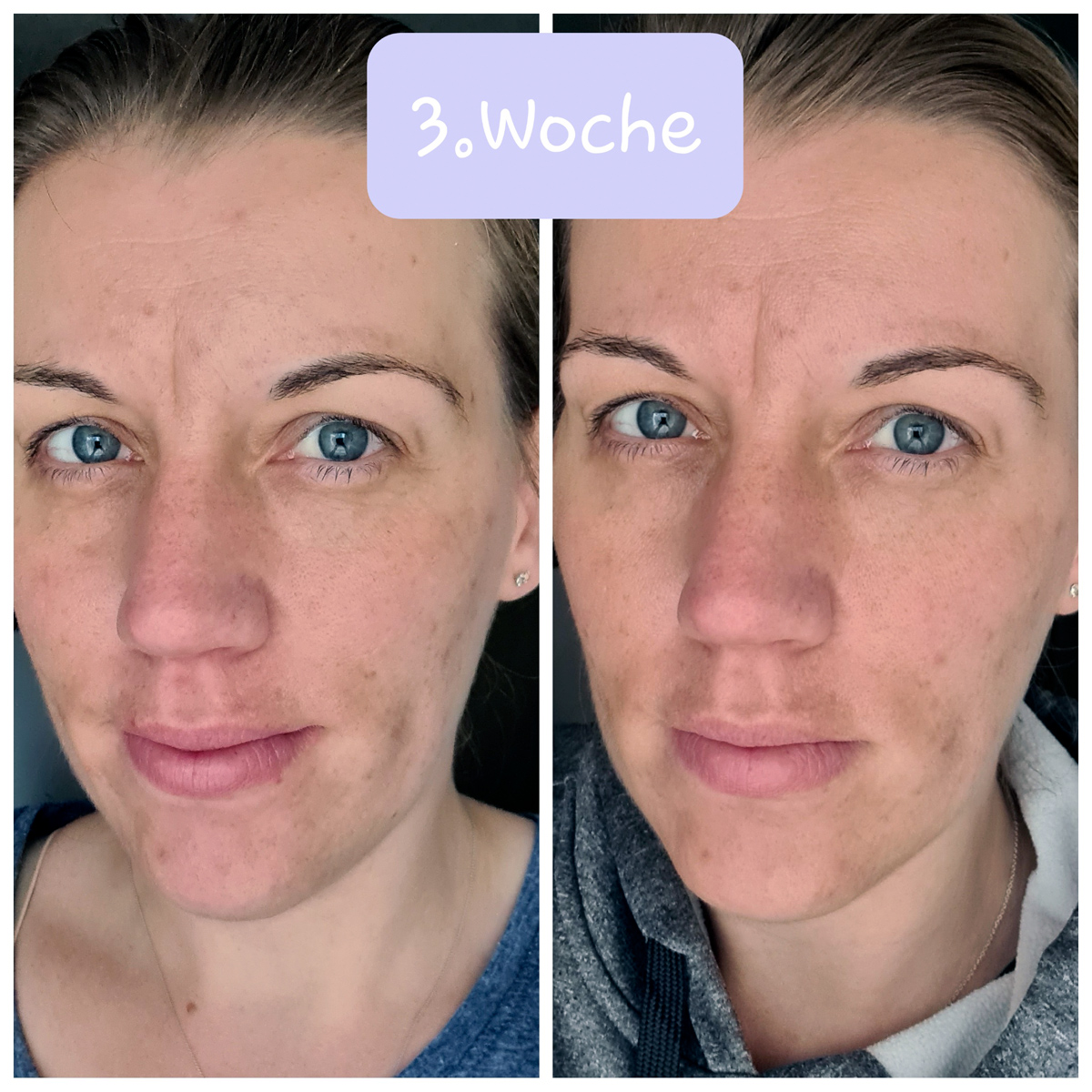 Skinlovers 4 Wochen Test