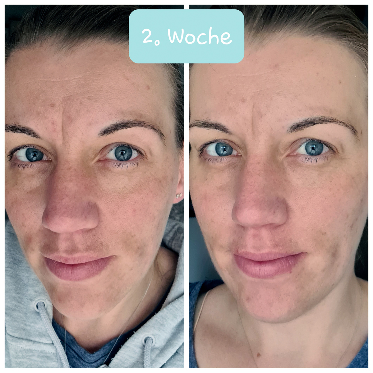 Skinlovers 4 Wochen Test